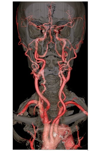 skull x-ray